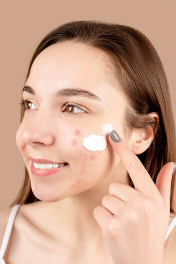 treatment options for blackheads